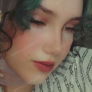 نتیجه ی عالی جراحی بینی استخوانی برای بانوان در تهران و کرج در مجموعه‌ی زیبایی گل برف